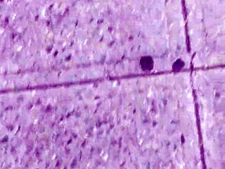 Amateur Dirty Calloused Barefoot Feet Fetish Closeup